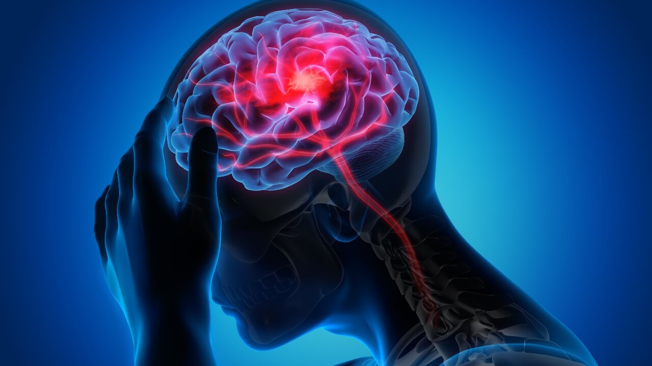 É possível sobreviver a um tumor cerebral?