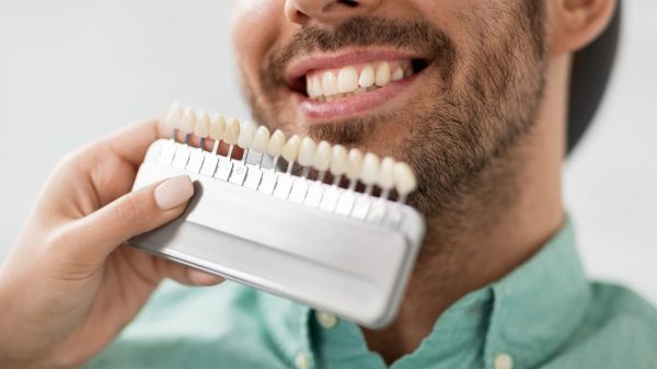 Facetas dentárias: entenda os riscos do procedimento