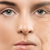 4 truques para evitar o envelhecimento precoce da pele