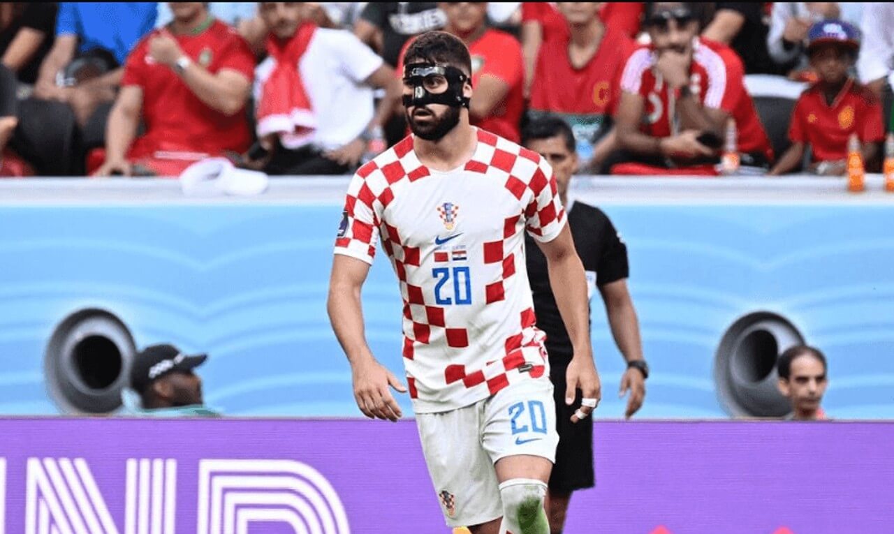 Copa do Mundo: otorrino explica máscara de jogador da Croácia