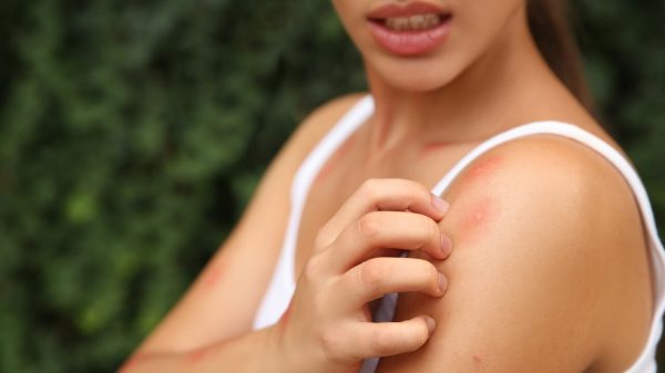 Por que algumas pessoas atraem mais mosquitos que outras? Ciência explica