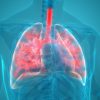 Dia Mundial da Pneumonia: saiba como prevenir a doença