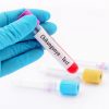 Estudantes criam teste de baixo custo para detectar Chikungunya