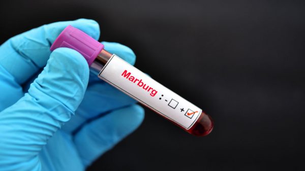 Infectologista explica os riscos por trás do surto do vírus Marburg