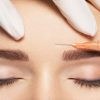 Anvisa alerta sobre Botox falsificado; saiba como identificar