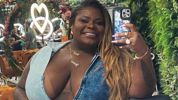 Por que Jojo Todynho adiou a cirurgia bariátrica? Médico analisa caso