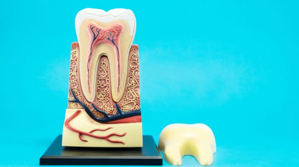 Células-tronco presentes na polpa do dente podem tratar doenças; veja