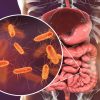 Bactéria intestinal pode ser a principal causa do Parkinson; entenda