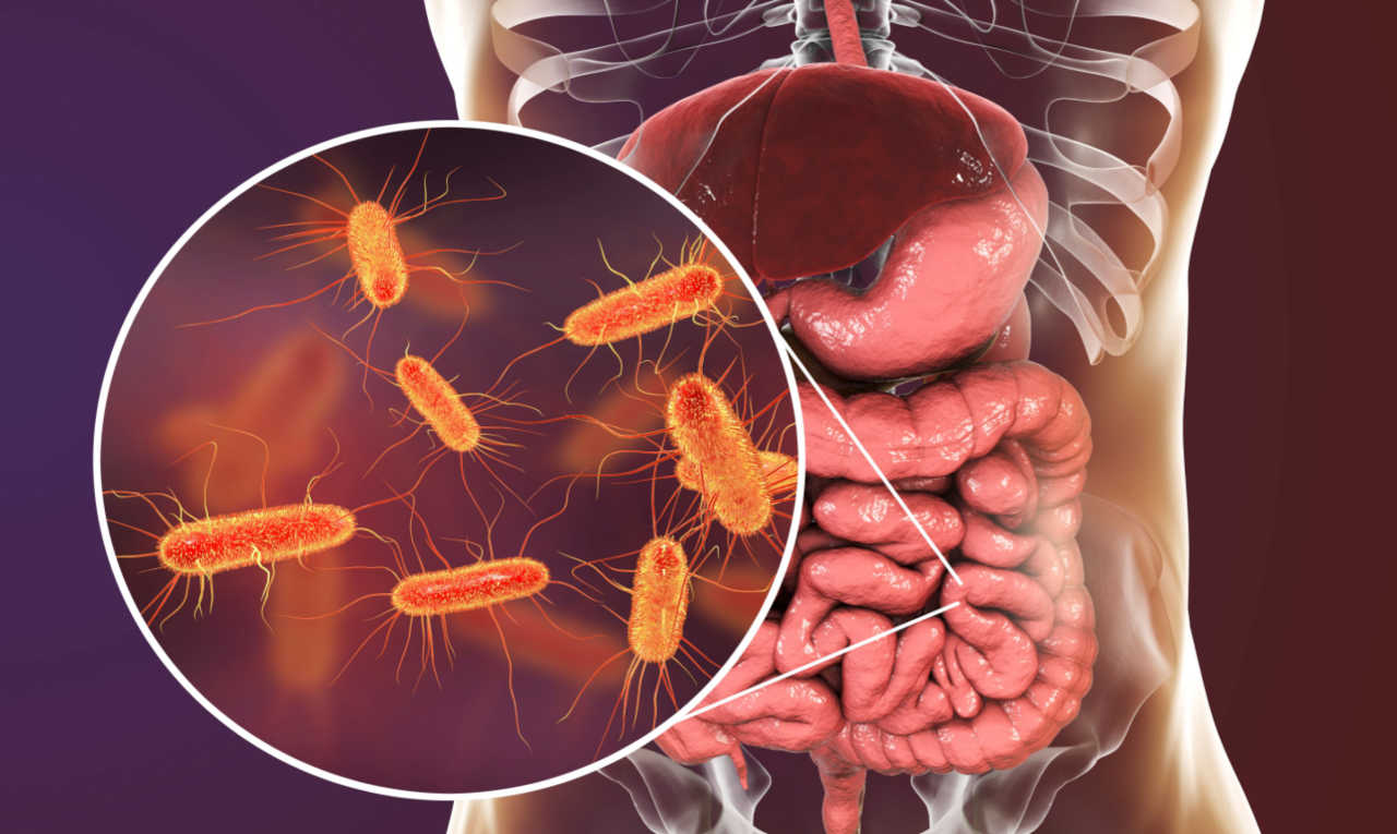 Bactéria intestinal pode ser a principal causa do Parkinson; entenda