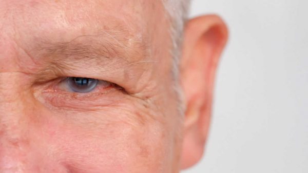 Maio verde: glaucoma não apresenta sinais e é irreversível