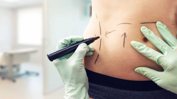 Cirurgia devolve autoestima após o parto: o que é o mommy makeover?