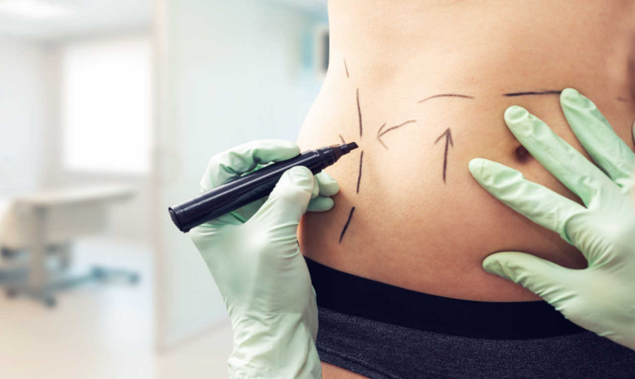 Cirurgia devolve autoestima após o parto: o que é o mommy makeover?