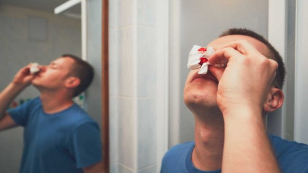 Sangramento nasal: saiba o que causa e como parar o sangue