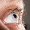 Junho Violeta: coçar os olhos aumenta risco de desenvolver ceratocone