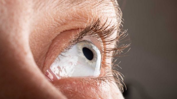 Junho Violeta: coçar os olhos aumenta risco de desenvolver ceratocone