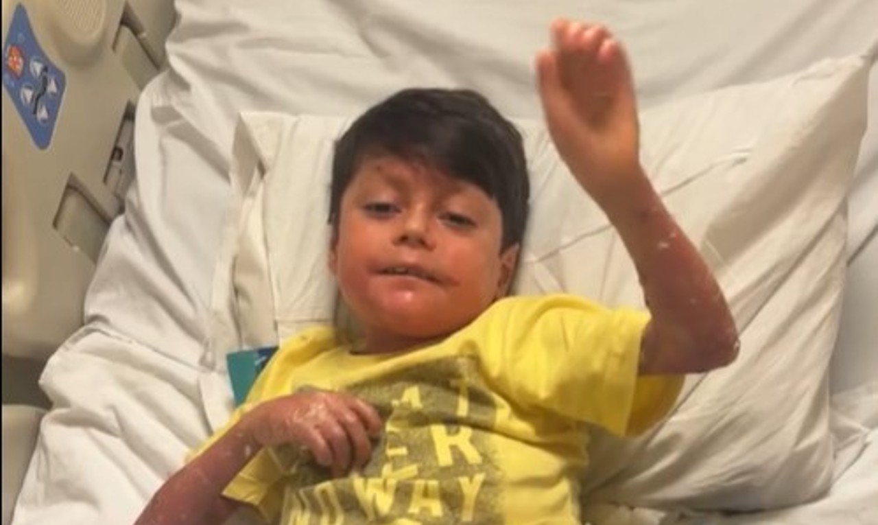 Epidermólise bolhosa: entenda a condição que causa “pele de borboleta”