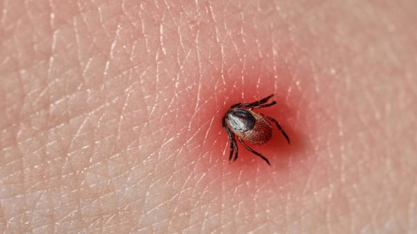 Vai viajar? Veja como prevenir a febre maculosa durante as férias de julho