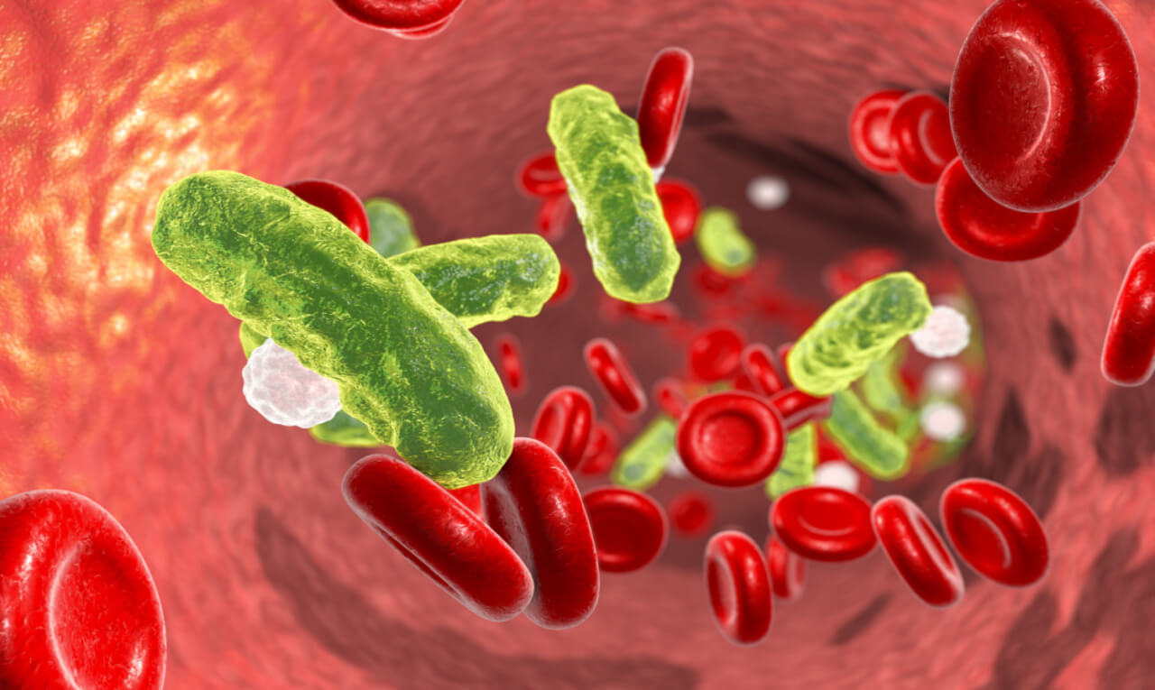 Septicemia: entenda a “doença dos famosos”, uma das mais letais do mundo