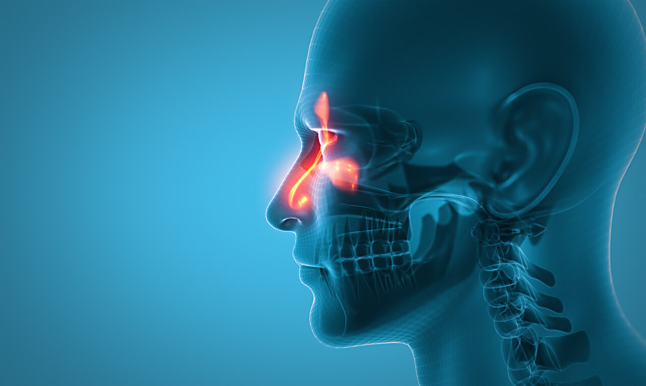 Sinusite pode matar: veja quais os sinais de agravamento da doença