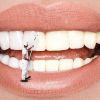 Hábitos que prejudicam os dentes