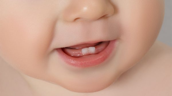 Bebê surpreende ao nascer com dente em SP; entenda