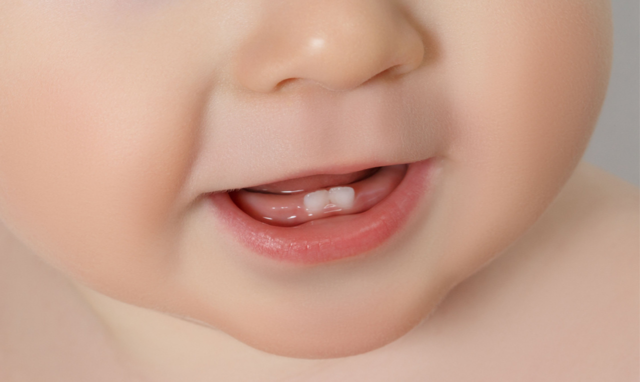 Bebê surpreende ao nascer com dente em SP; entenda