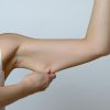 Flacidez nos braços: conheça técnica que retrai a pele local