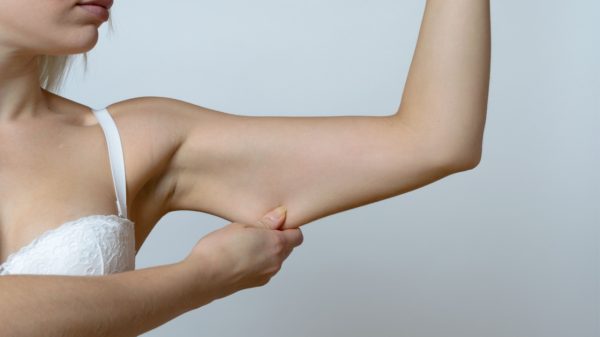 Flacidez nos braços: conheça técnica que retrai a pele local