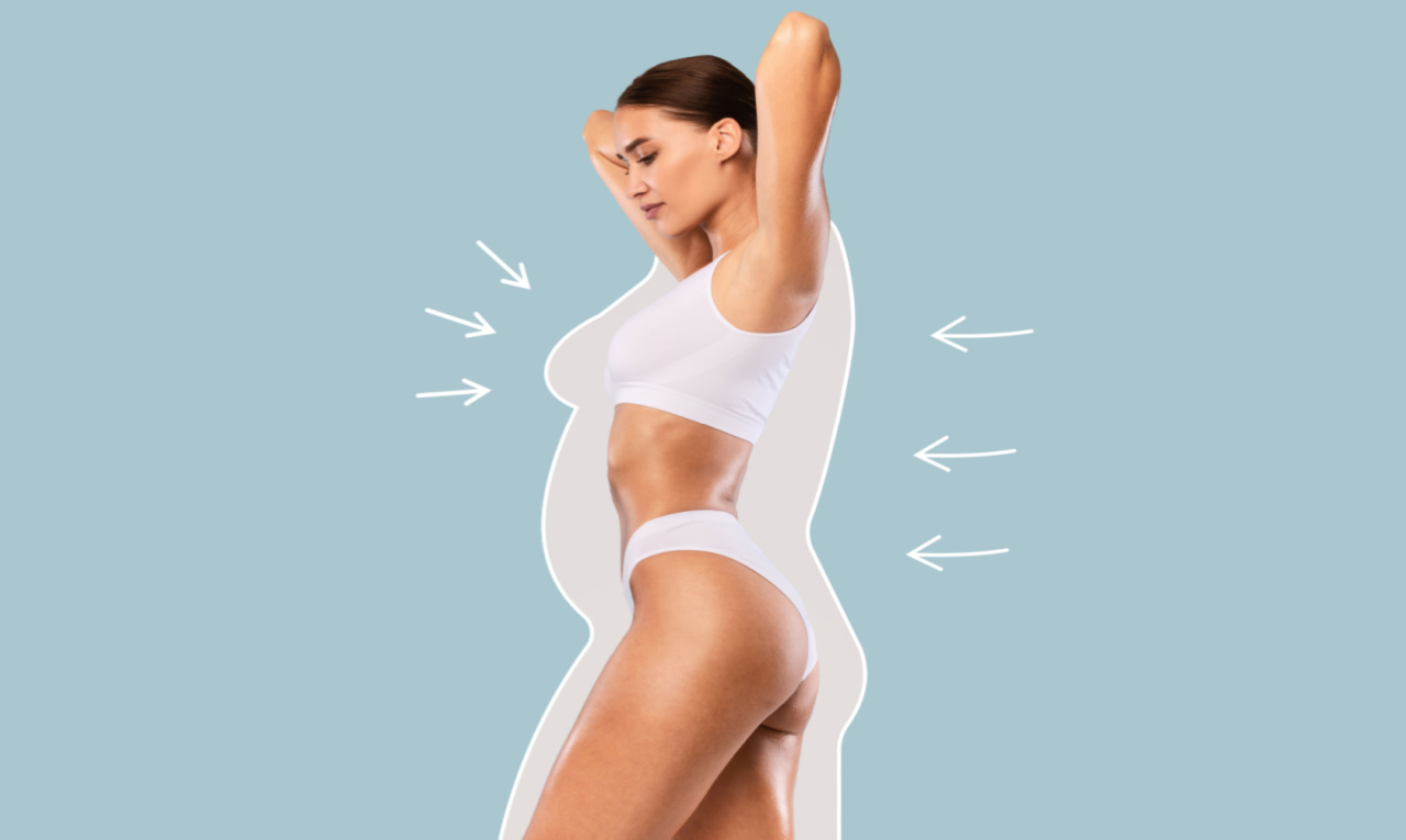 Lipoaspiração emagrece? Cirurgião plástico responde