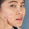 Descubra 4 maus hábitos do dia a dia que causam danos à pele