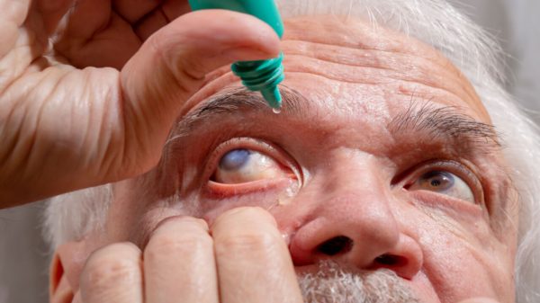 Efeito do CBD no organismo pode ajudar a reduzir o principal fator de risco para o glaucoma. Mais estudos são necessários