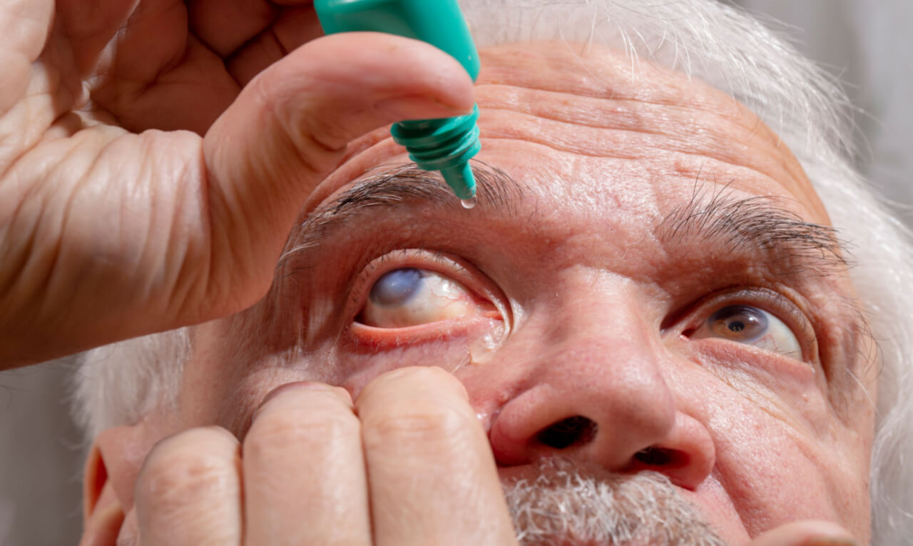 Efeito do CBD no organismo pode ajudar a reduzir o principal fator de risco para o glaucoma. Mais estudos são necessários