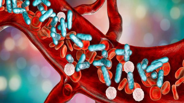 Sepse mata uma pessoa a cada 2,8 segundos: entenda a septicemia