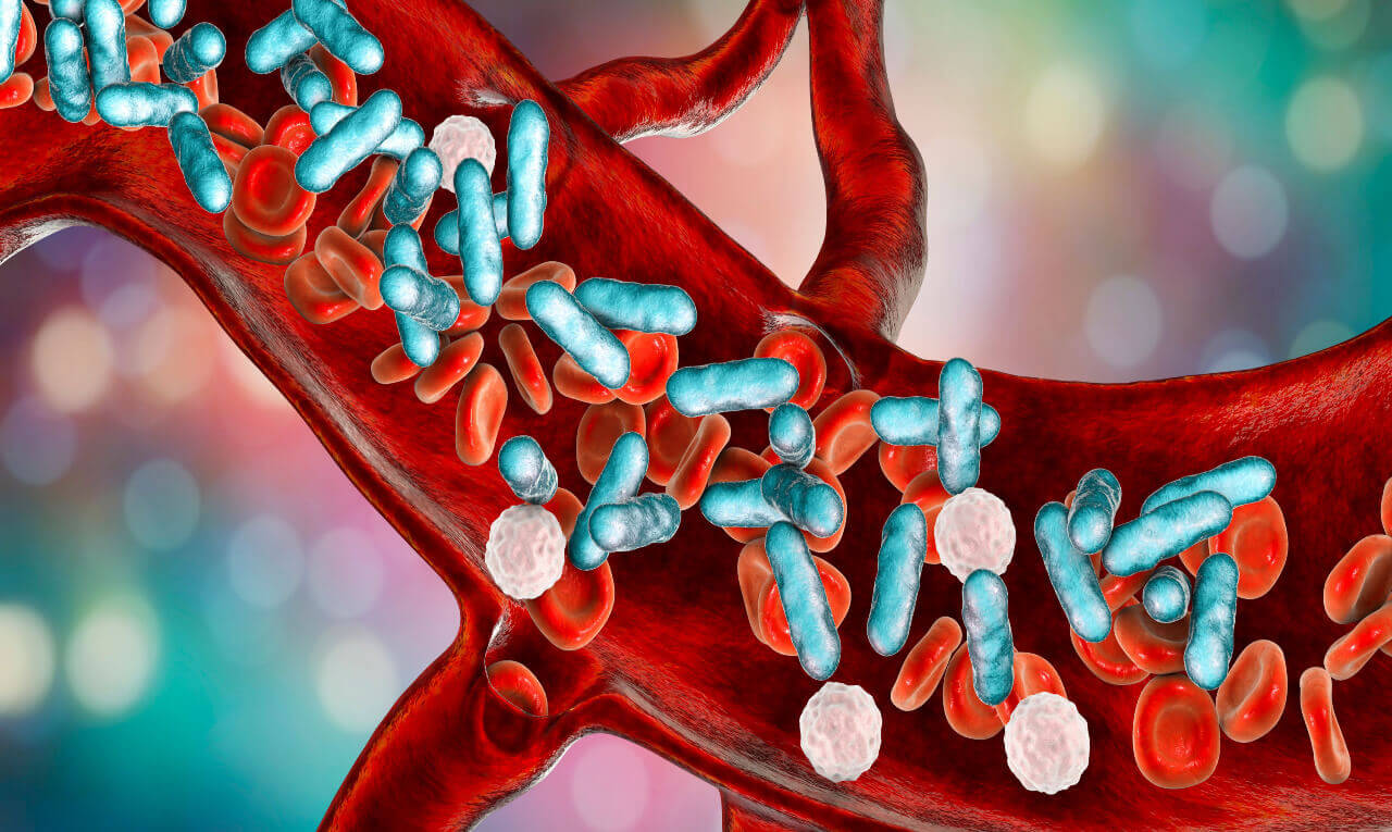 Sepse mata uma pessoa a cada 2,8 segundos: entenda a septicemia
