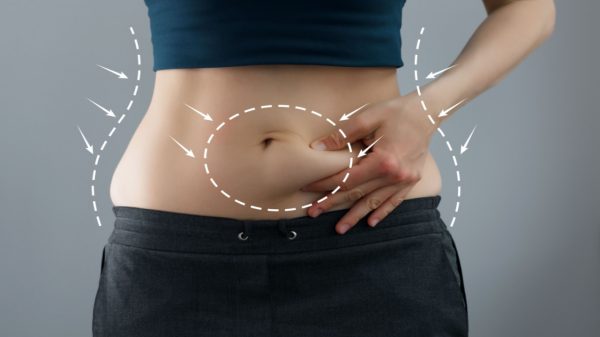 Abdominoplastia: entenda as diferentes finalidades do procedimento