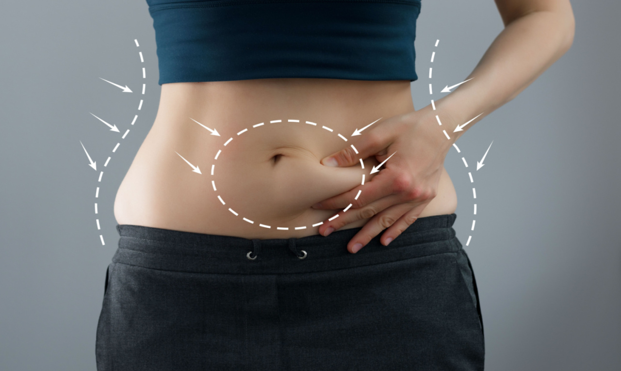 Abdominoplastia: entenda as diferentes finalidades do procedimento