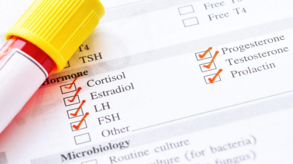 Hormônios: entenda a importância de fazer o check-up hormonal