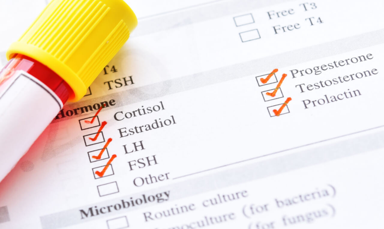 Hormônios: entenda a importância de fazer o check-up hormonal