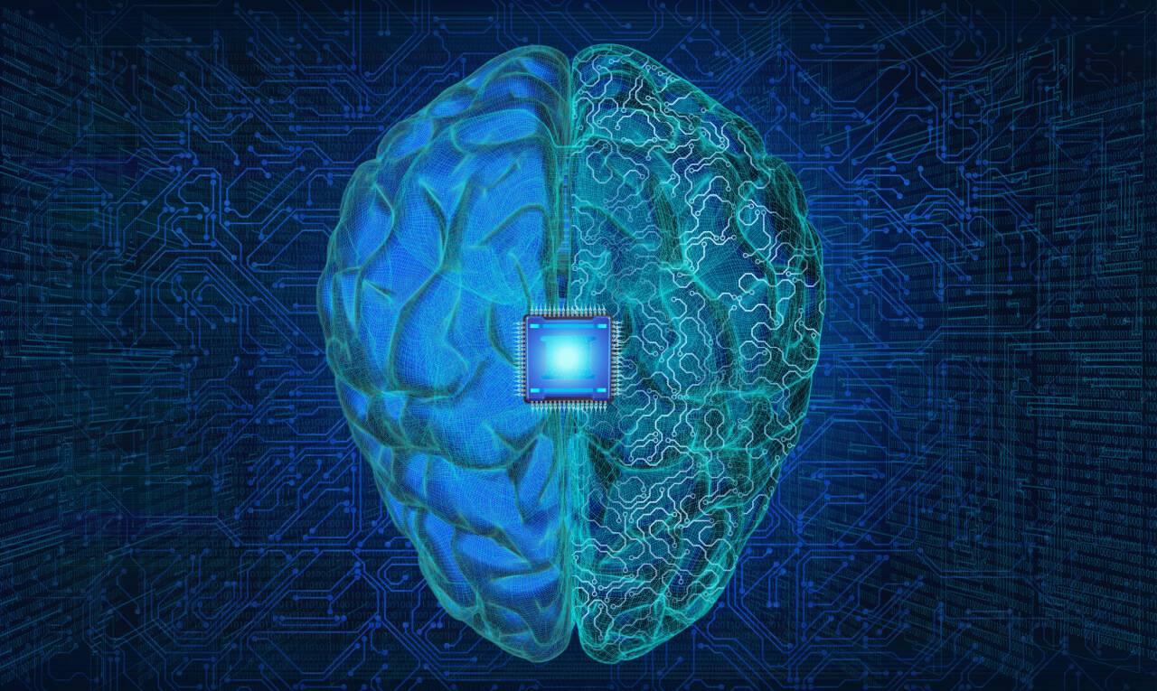 AVC: implantes cerebrais podem reduzir sequelas? Entenda
