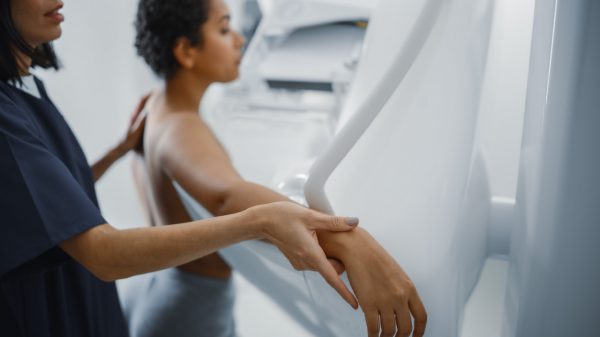 Mamografia: 10 informações que toda mulher precisa saber
