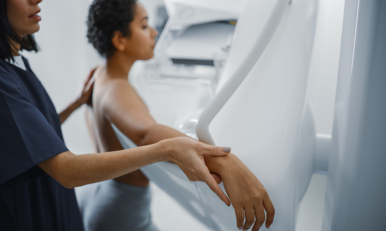 Mamografia: 10 informações que toda mulher precisa saber