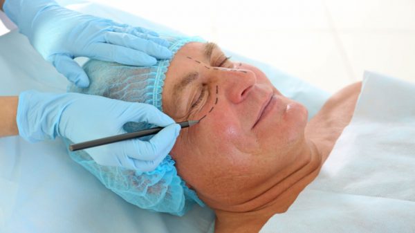 Facelift: cirurgia promove rejuvenescimento facial