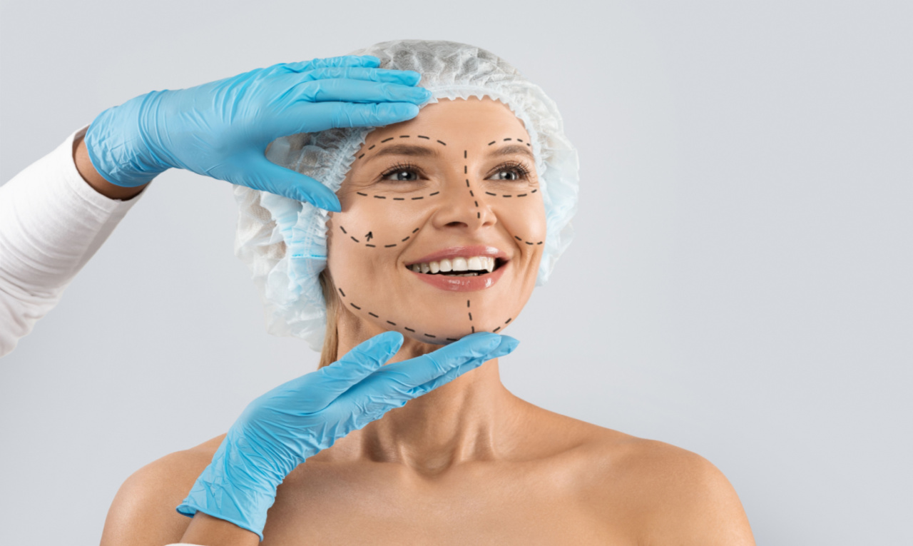 Deep plane facelift: especialista aponta vantagens e cuidados do procedimento