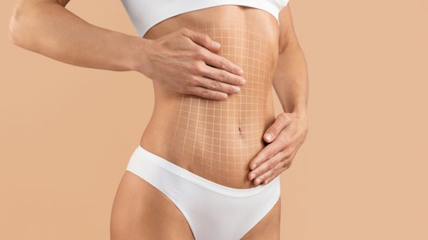 Qual a diferença entre lipoaspiração e lipoescultura? Cirurgião explica