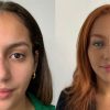 Brasileira viraliza após mudar cor dos olhos: entenda o procedimento