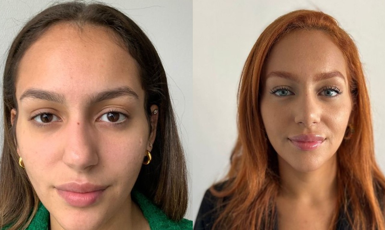 Brasileira viraliza após mudar cor dos olhos: entenda o procedimento