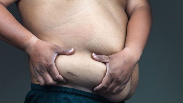 10 mudanças que a obesidade causa no corpo e como combatê-las