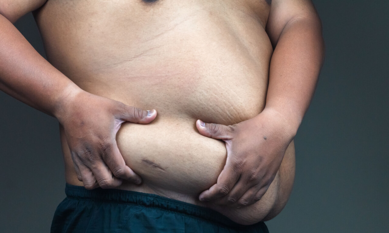 10 mudanças que a obesidade causa no corpo e como combatê-las