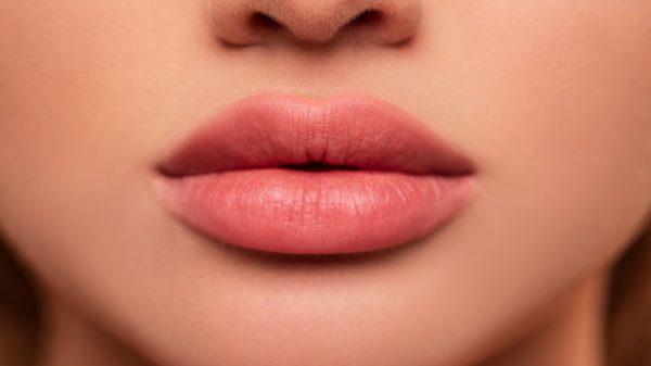 Preenchimento labial: 8 perguntas e respostas sobre o procedimento