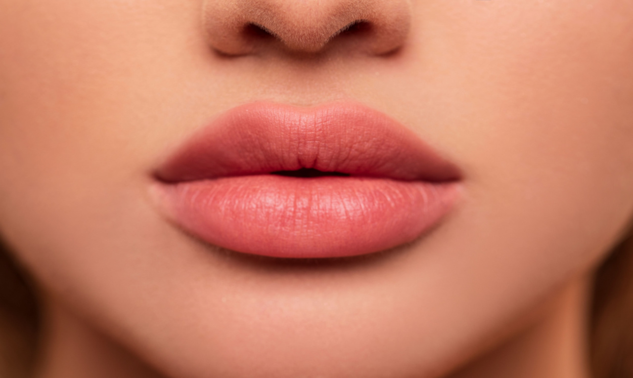 Preenchimento labial: 8 perguntas e respostas sobre o procedimento